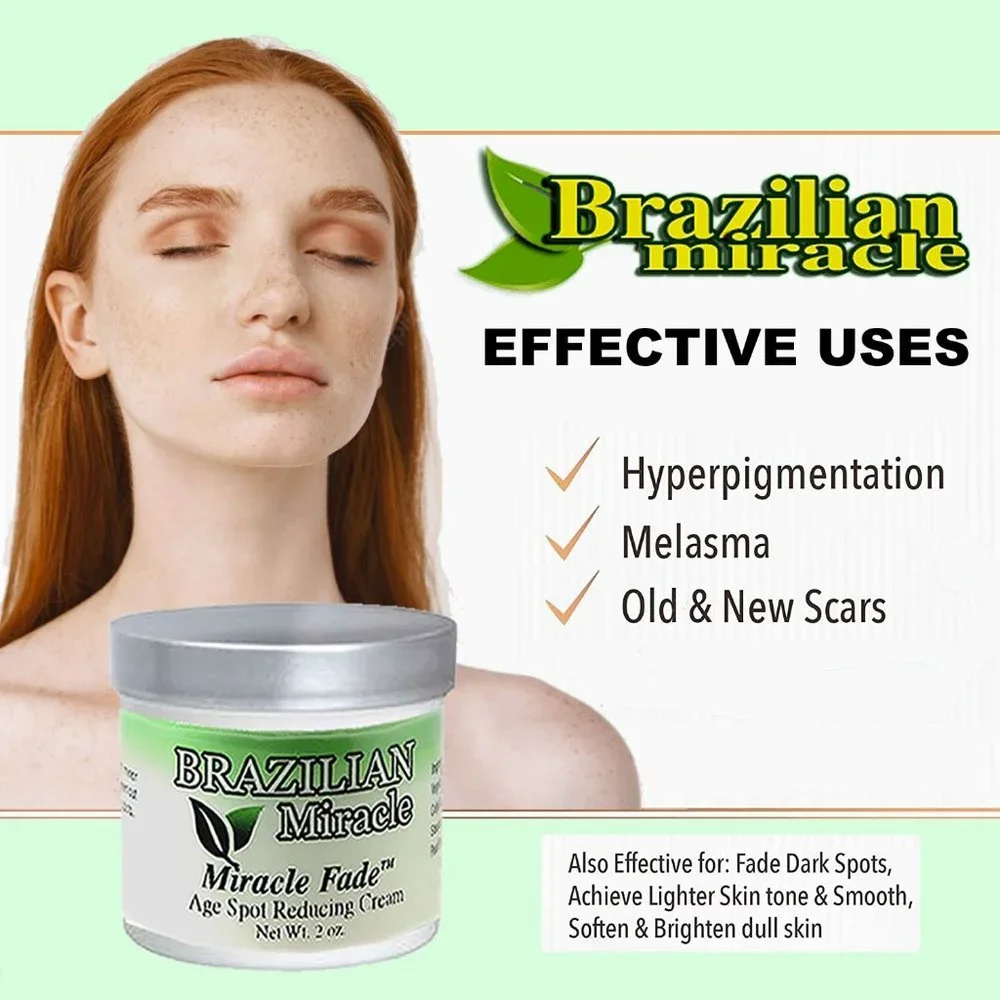 Anti Melasma Cream‎ Dark Spots Age Spots Freckles